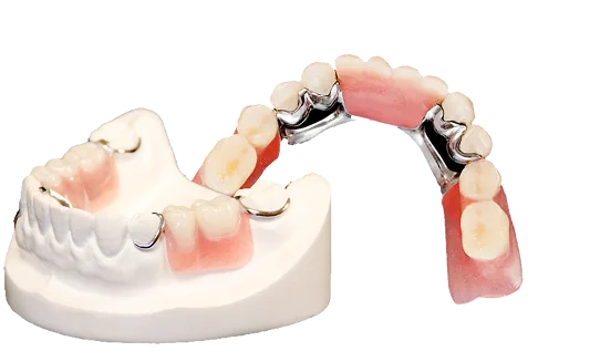 Partial denture