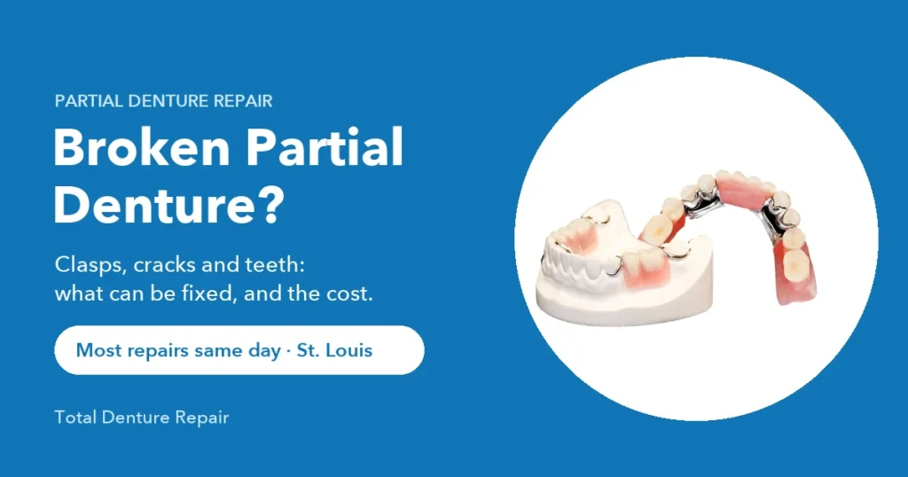 Partial denture with metal clasps, the kind Total Denture Repair fixes in St. Louis